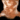 Tattered Pelt.png