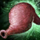 Swollen Hydra Gut.png